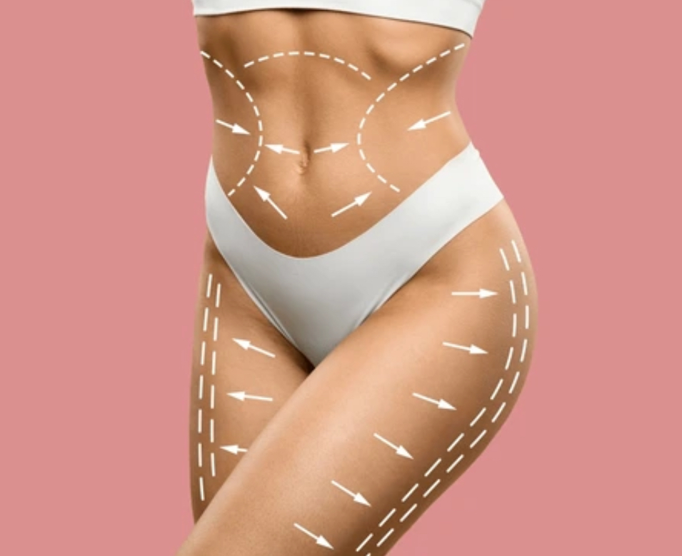 Veluxe Bodysculpting