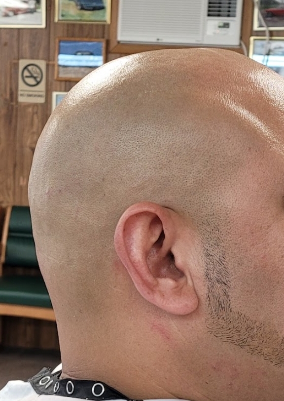 Straight Razor Hot Towel Head Shave