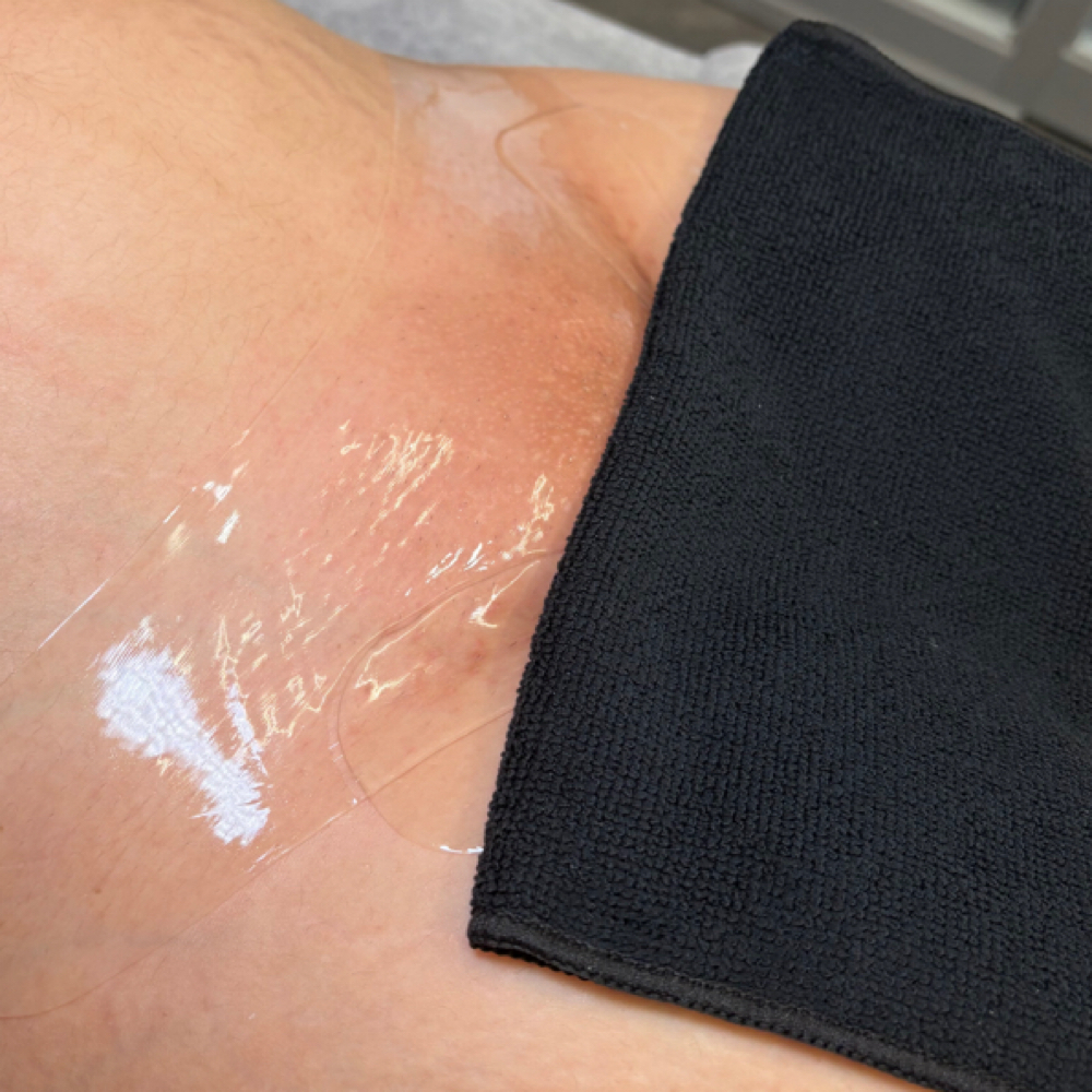 Full Vajacial at You Esthetics in Salem, MA