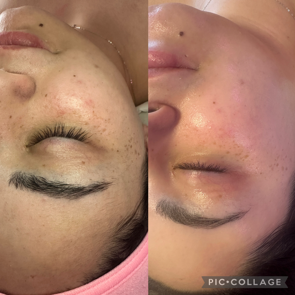 Express Facial