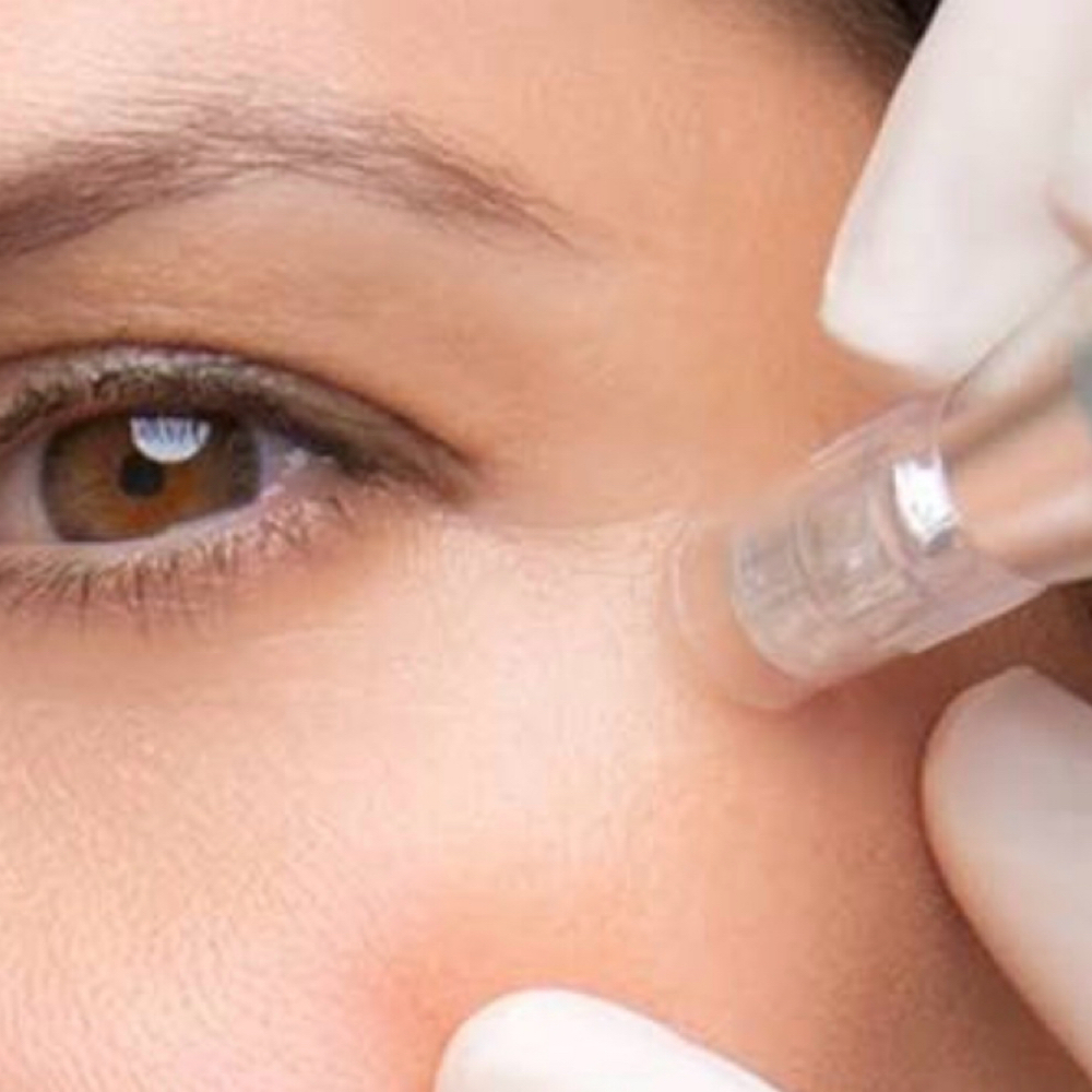 Eye treatment at Monarch Esthetics in Phoenix, AZ