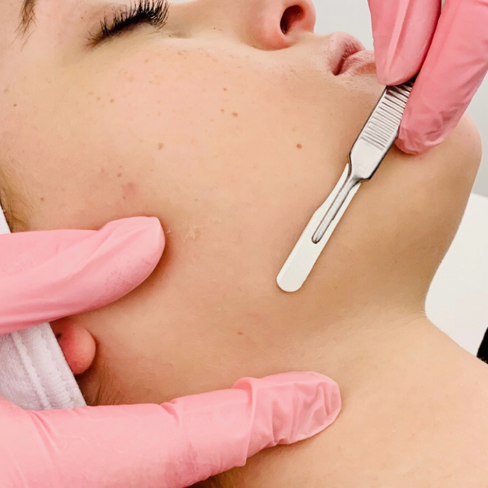 Dermaplane Add On at The Esty Queen in Fresno, CA
