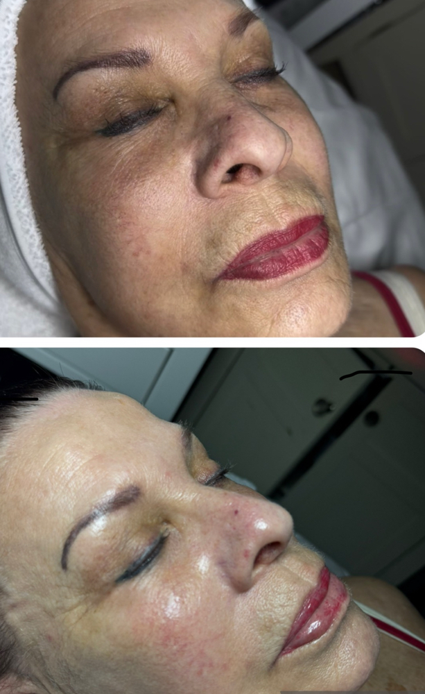 Anti-Aging Facial Treatment at Beauty Retreat in mt hope, WV
