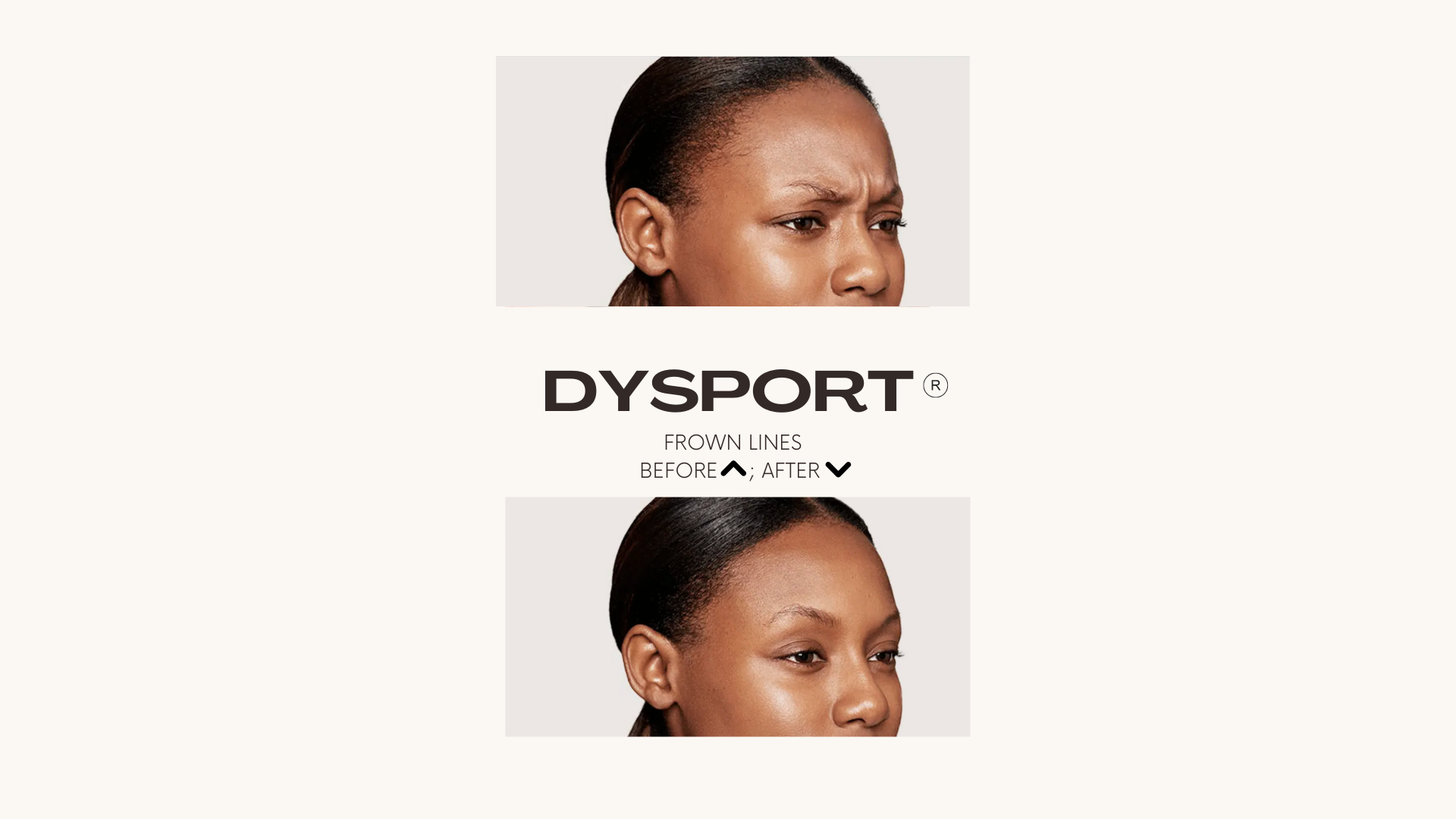 Dysport®