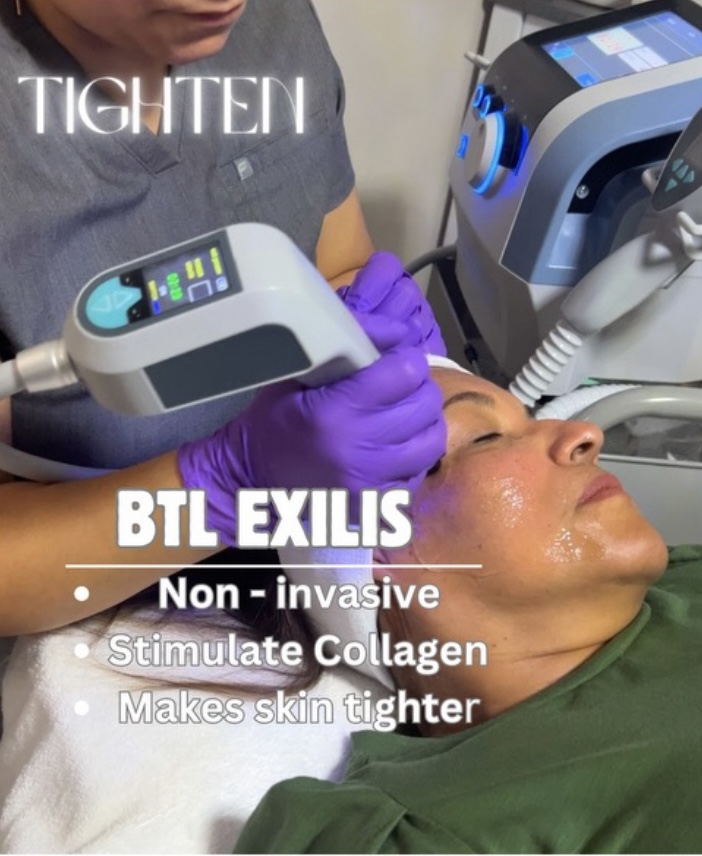 Exilis Ultra 360 Face Lift