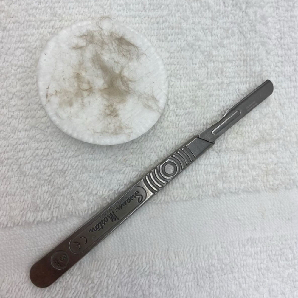Dermaplane Facial at Future Glow Aesthetics in Lafayette, GA