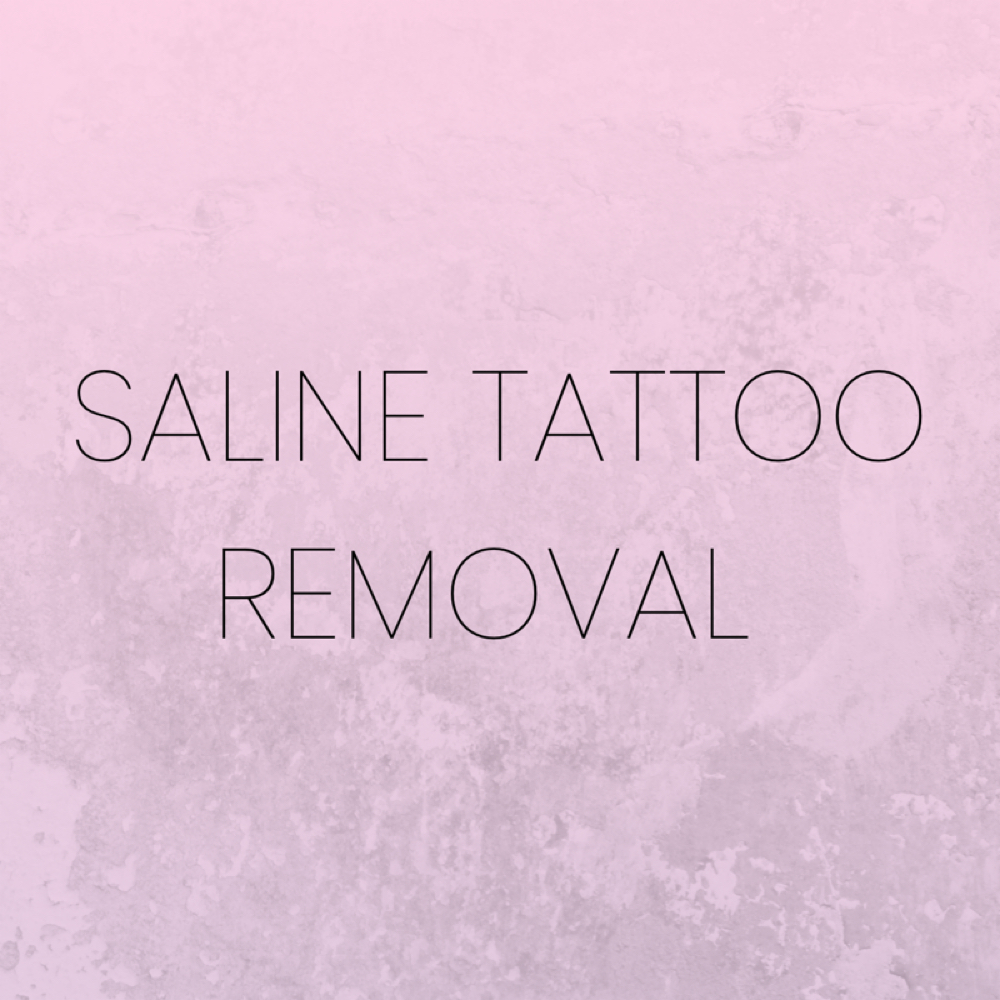 Tattoo Removal (requires consultation) at Pink Ink Vancouver in Vancouver, WA