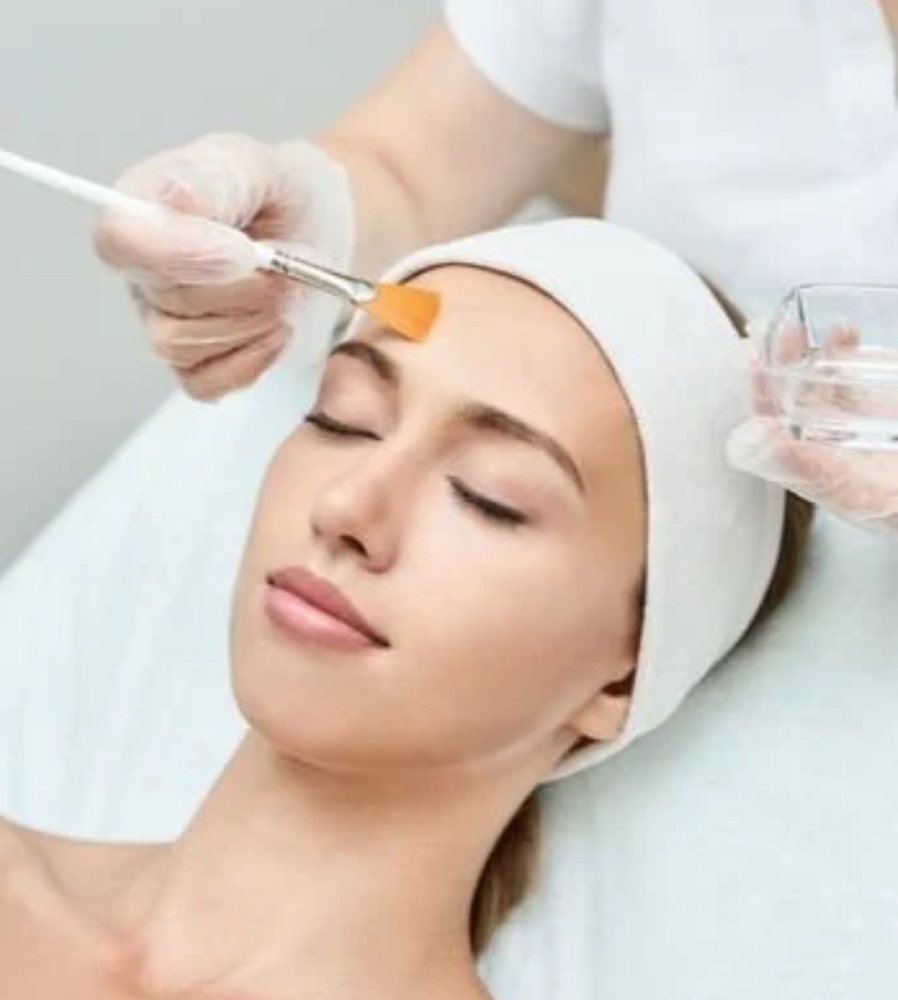 Chemical peel