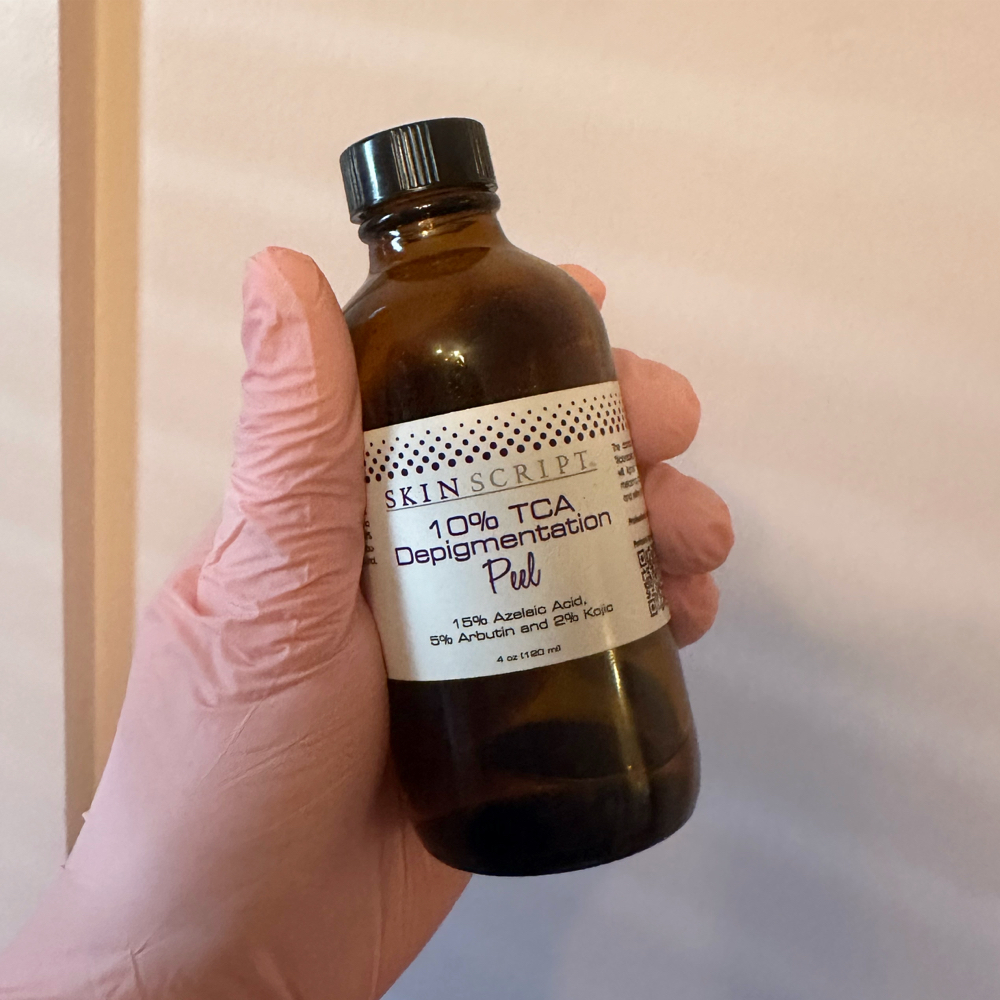 Custom Chemical Peel
