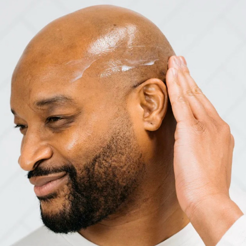 Scalp & Hairline Renewal Treatment