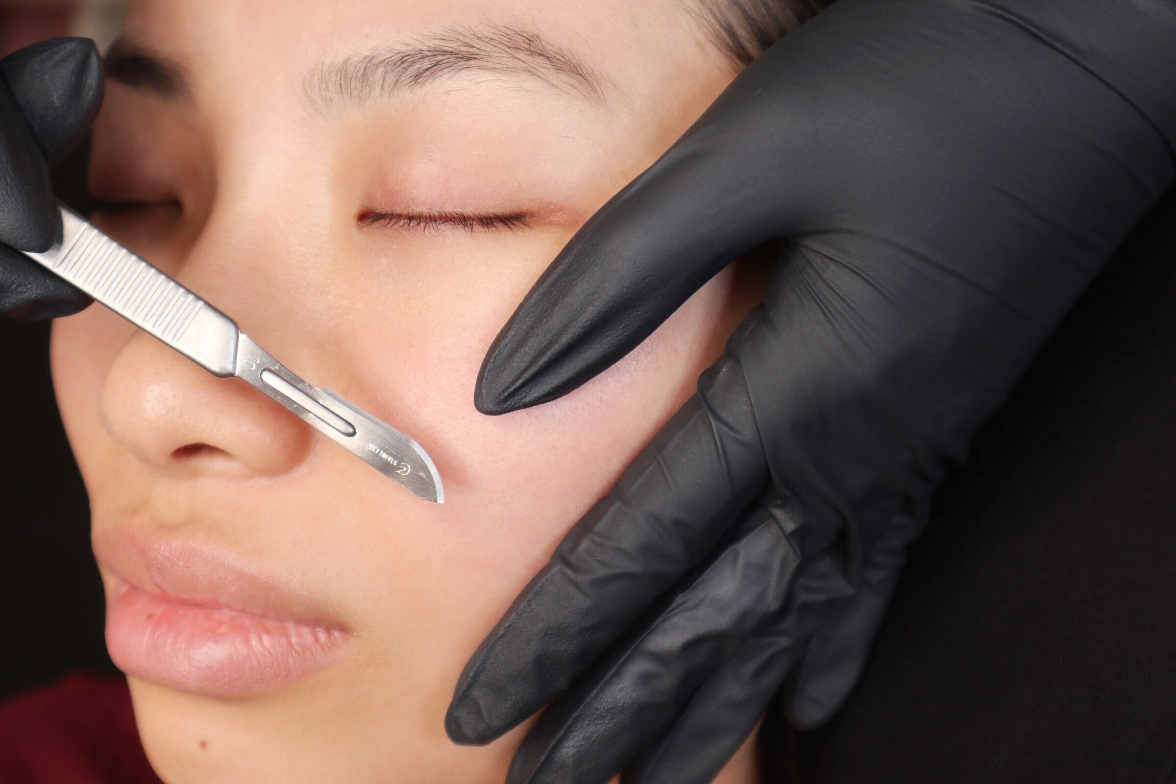 Dermaplaning
