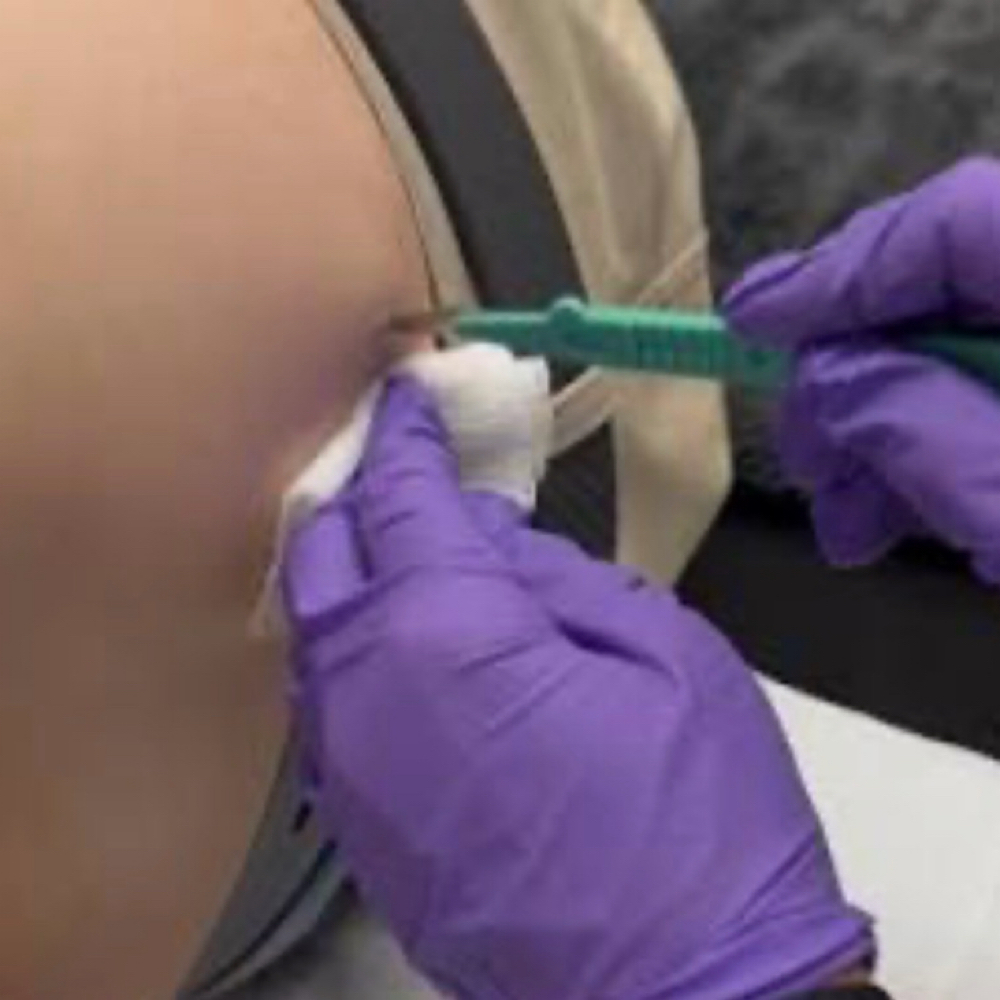 Male Hormone Replacment Pellet