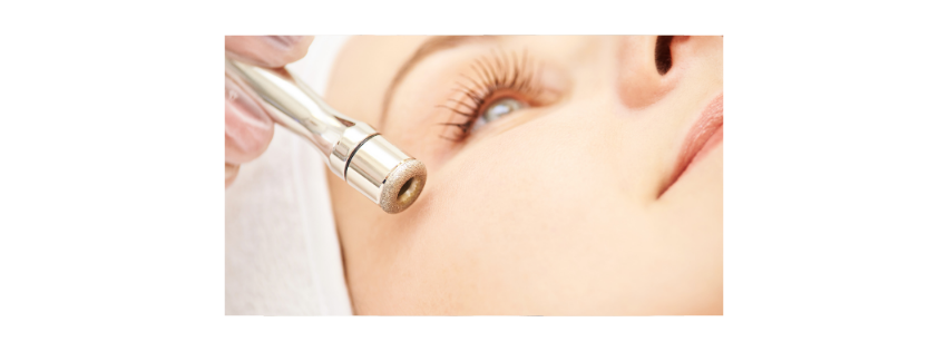 Microdermabrasion