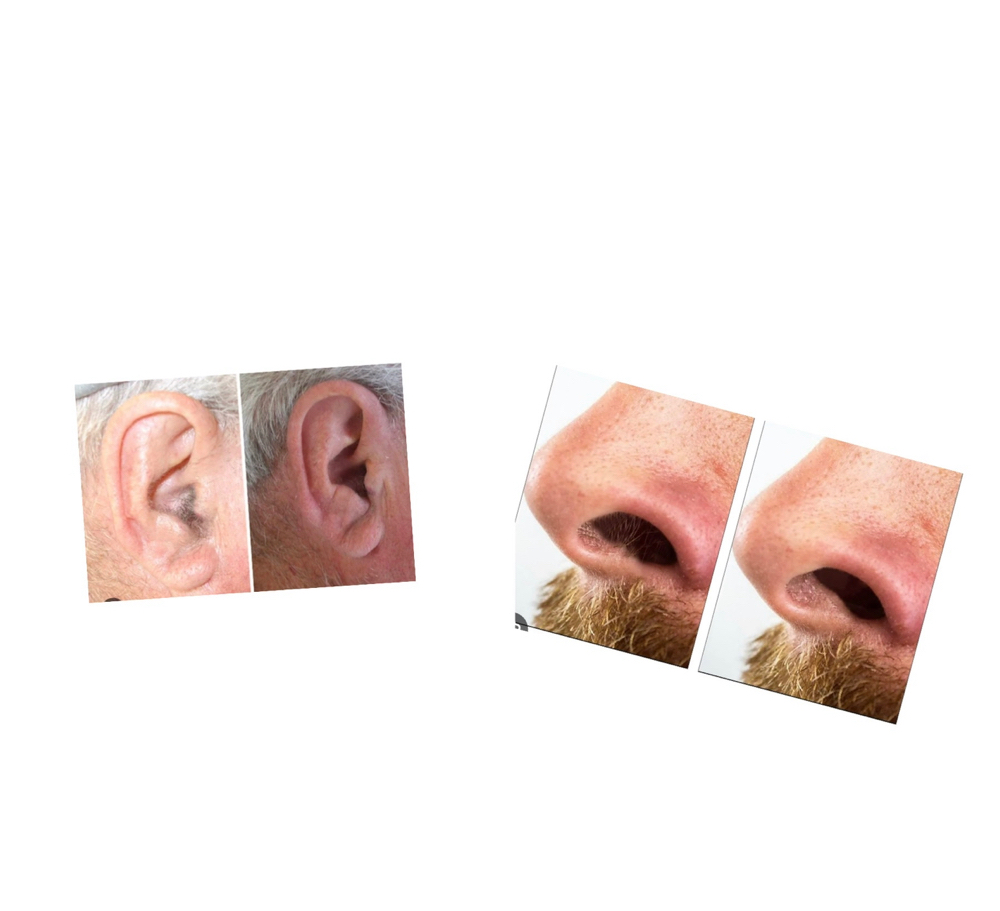 Ear & Nose Wax