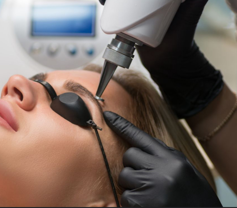 Laser Brows Removal