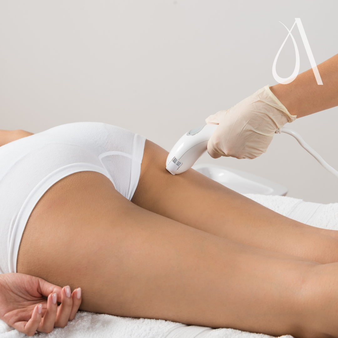 Laser - glutes + lower back - 1 s at Ambar Aesthetics in Kissimmee, FL