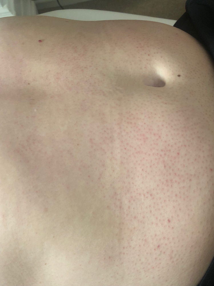 Stomach Waxing