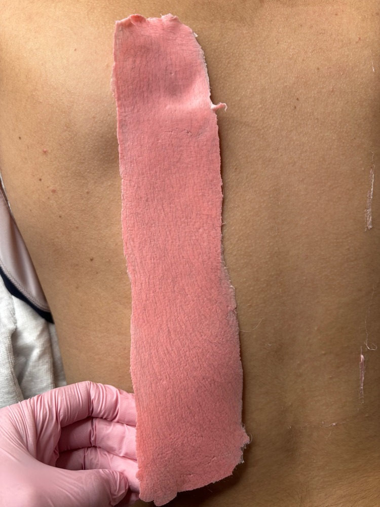 Back Wax / Depilación De Espalda