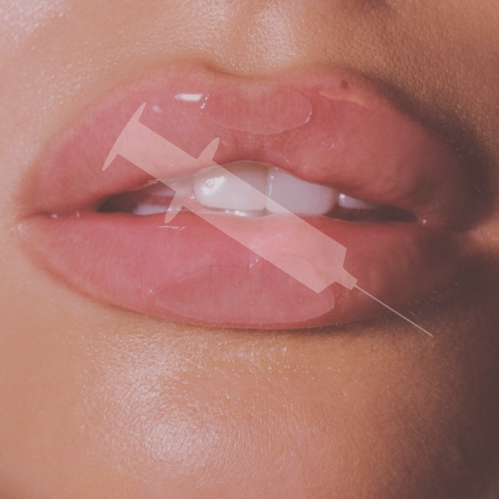 Lip Filler at Glow Aesthetics Rx PLLC in Austin, TX