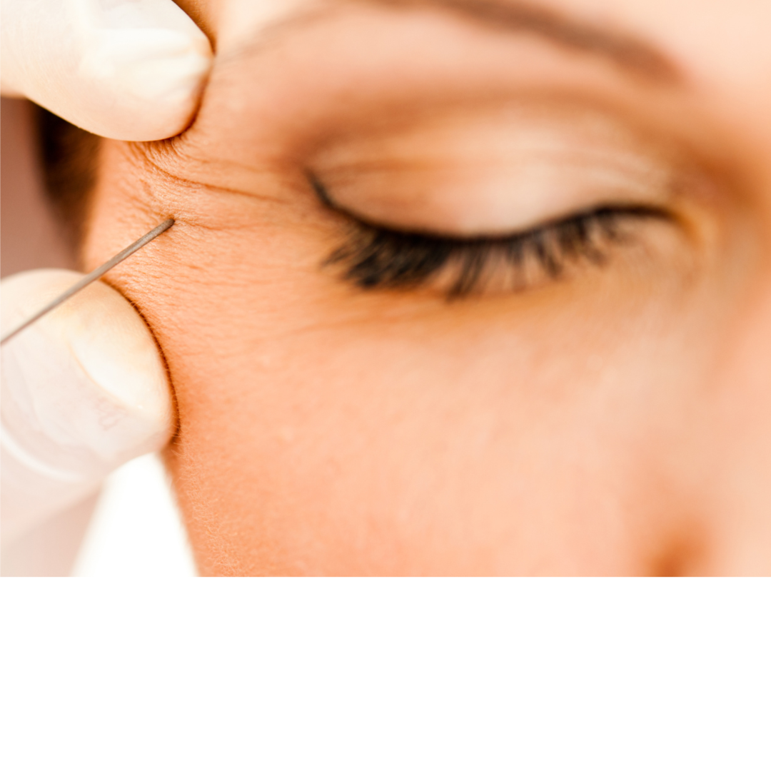 MesoTox at Eden Rose Health and Wellness in Bridgeport, CT