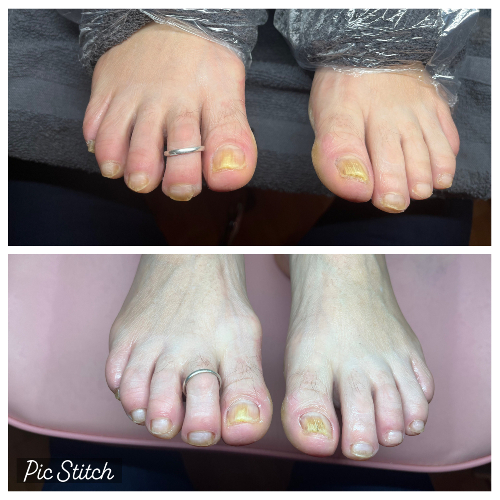 Specialized Pedicure