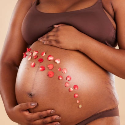 Belly Facial at Eyes on The Run and Esthetics in Buffalo, NY