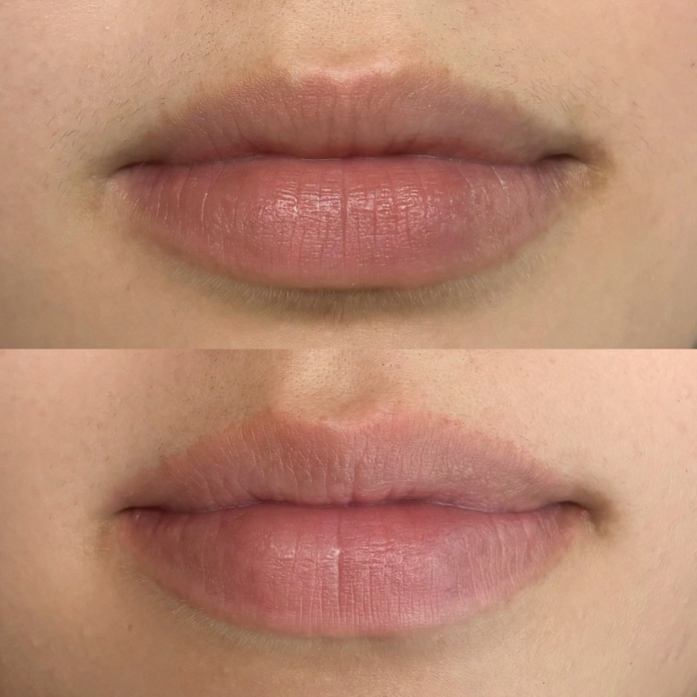 Lip Line Design (Overlined Lip) at Cocoa Square in Grapevine, TX