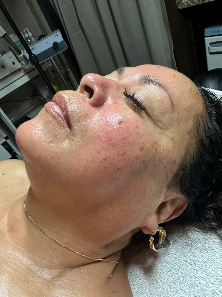 Anti Aging Facial