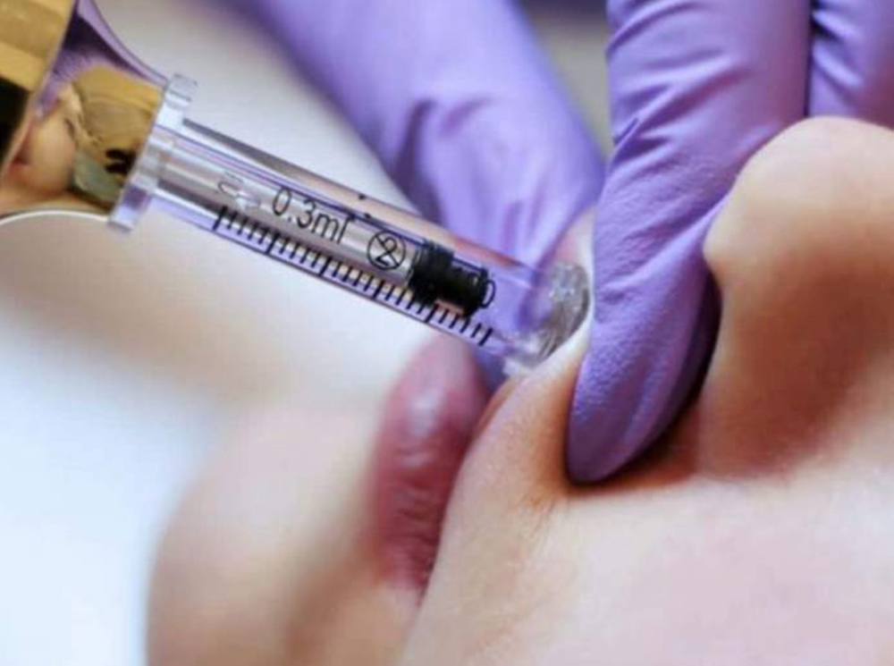 Needleless Lip Filler Touch Ups 1ML