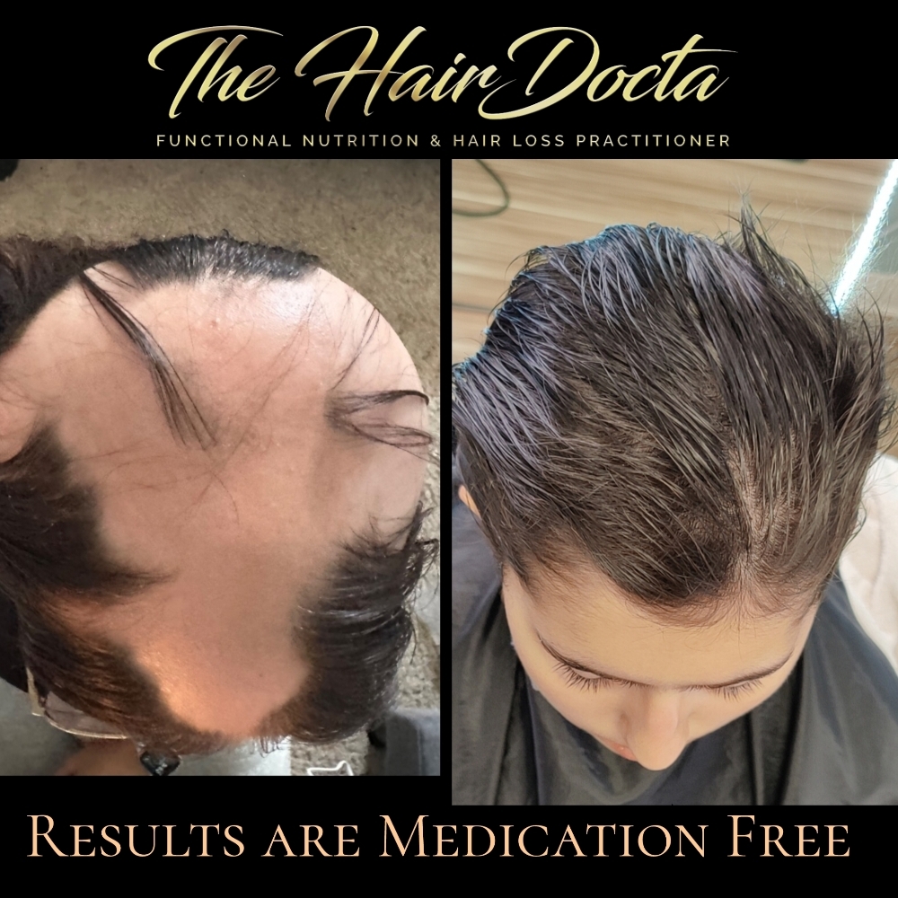 ⚠️Hair Restoration Therapy at The Hairdocta Clinic in Kansas City, MO