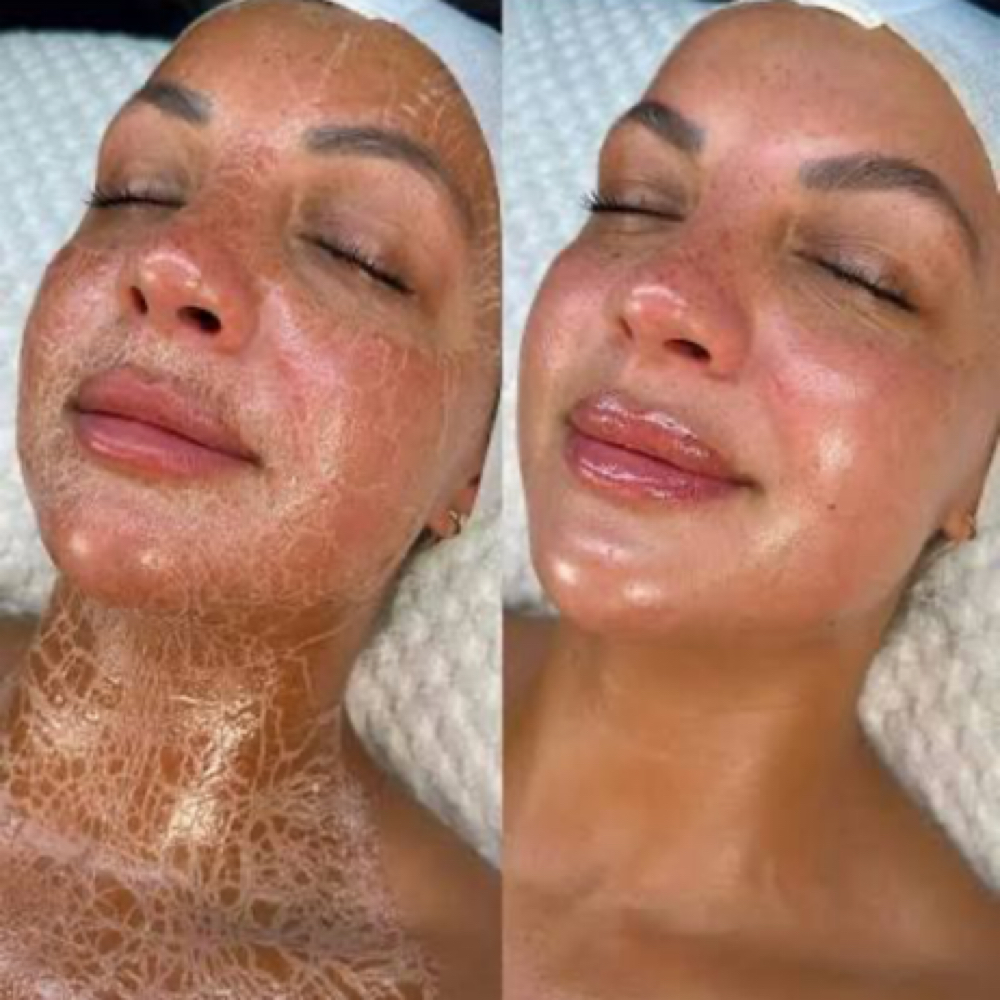 Firming Beauty Treatment at Beauty And Body in San Dimas, CA