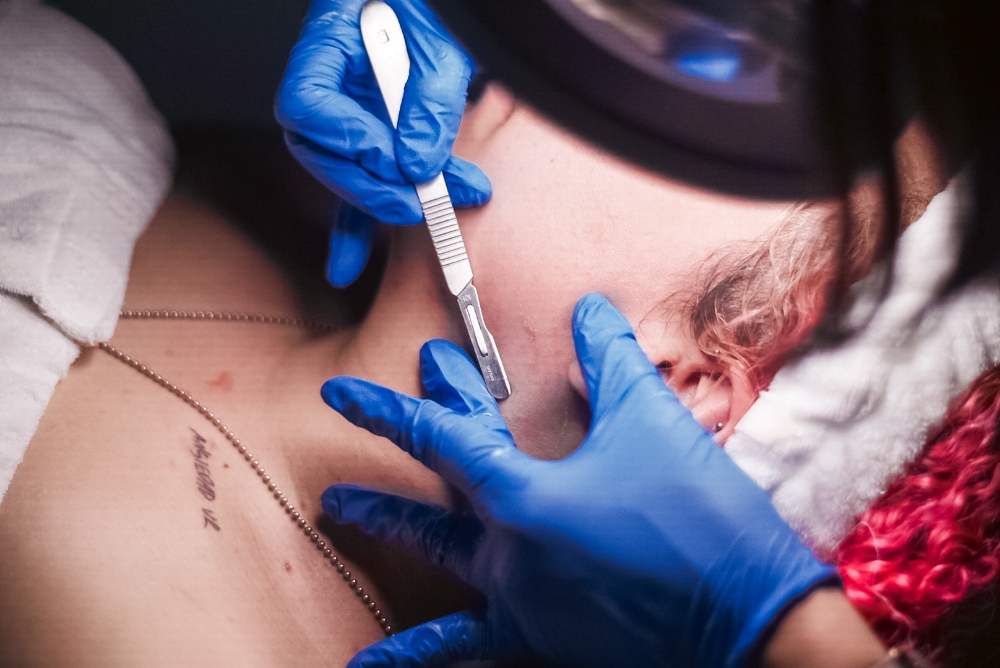 Dermaplaning