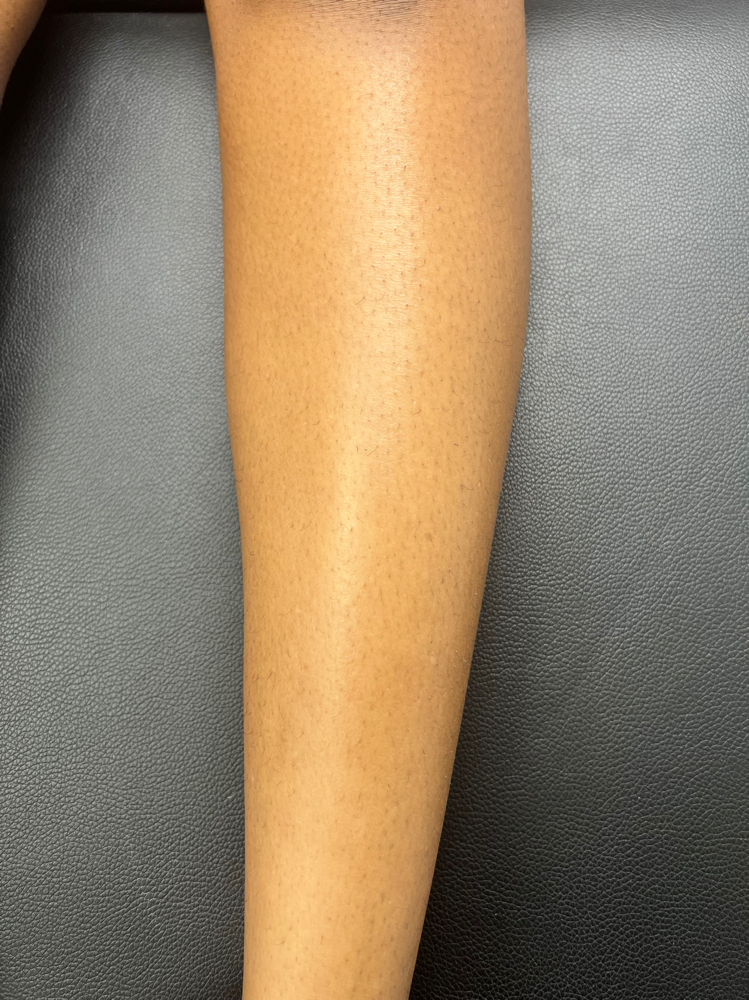 Legs