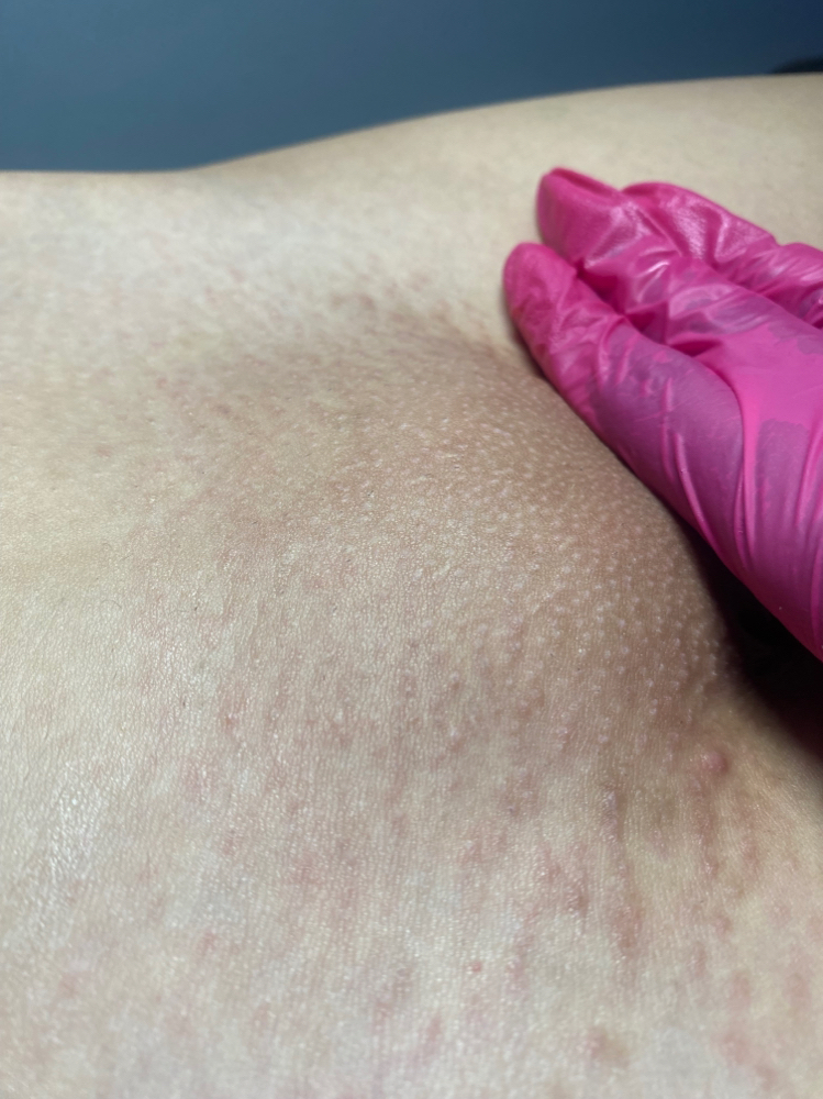 Brazilian Wax
