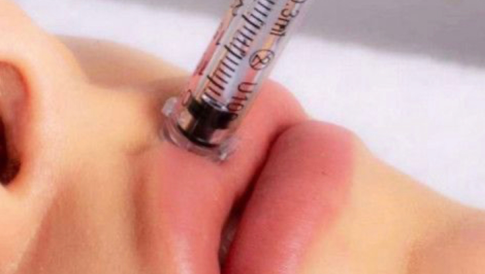 Hidratacion Y Volumen De Labios