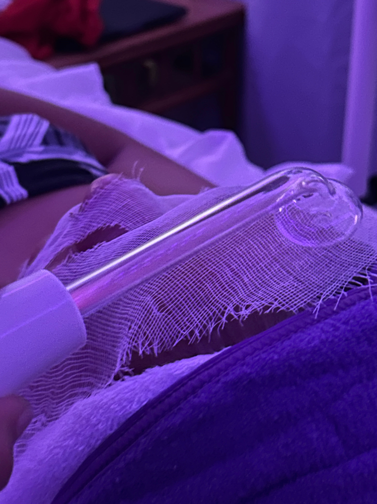 High Frequency at Anela Esthetics in Mountain View, HI