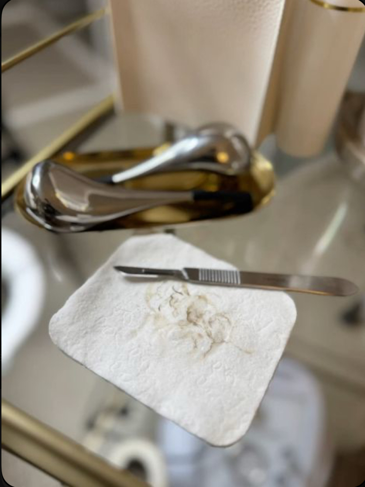 Add On - Dermaplane