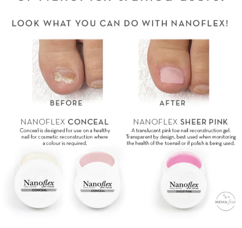 NanoFlex-Toenail Reconstructions