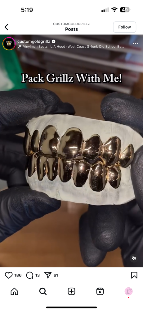 Grillz Teeth Impressions
