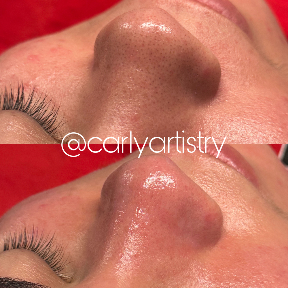 Custom Facial