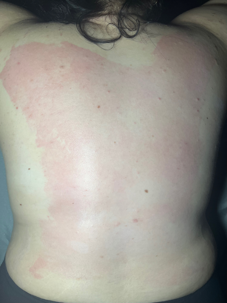 Full Custom Back Facial