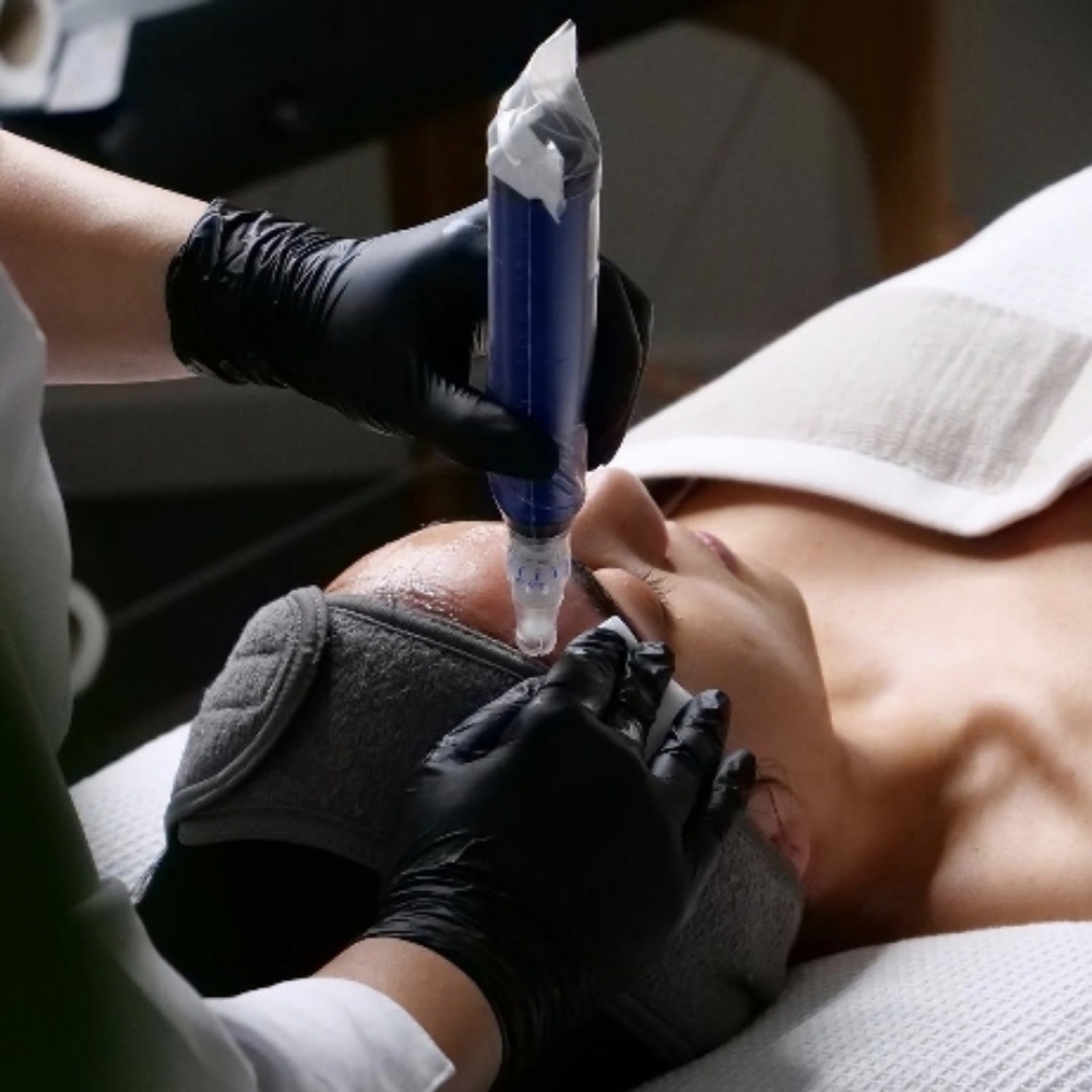 SkinPen Microneedling at LUXE SKIN LAB in Palos Hills, IL