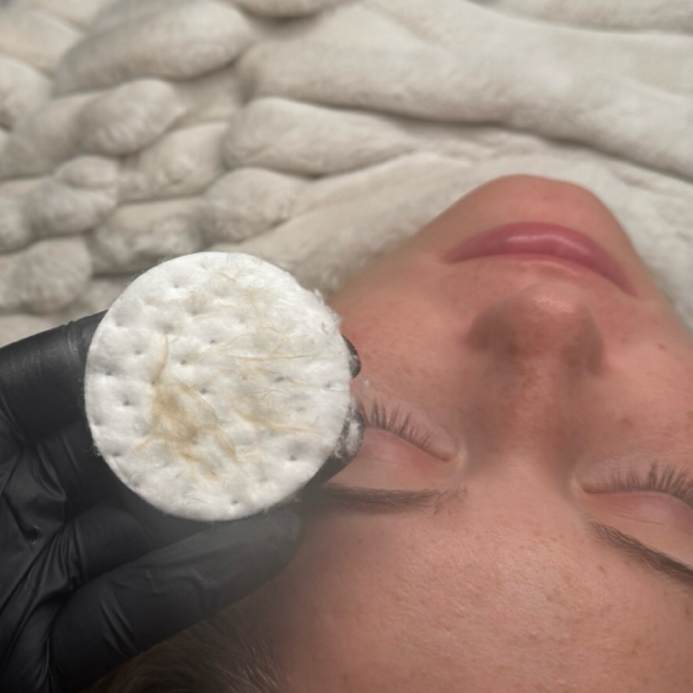 Dermaplane Facial at LASHANDOUT in Kernersville, NC