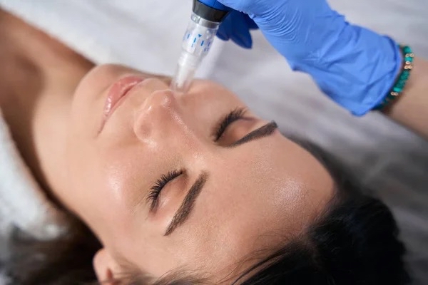 Microneedling