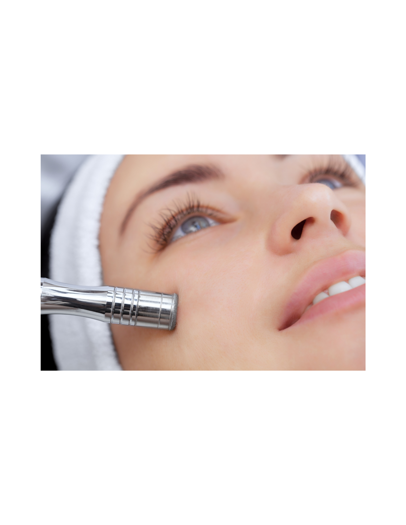 Microdermabrasion