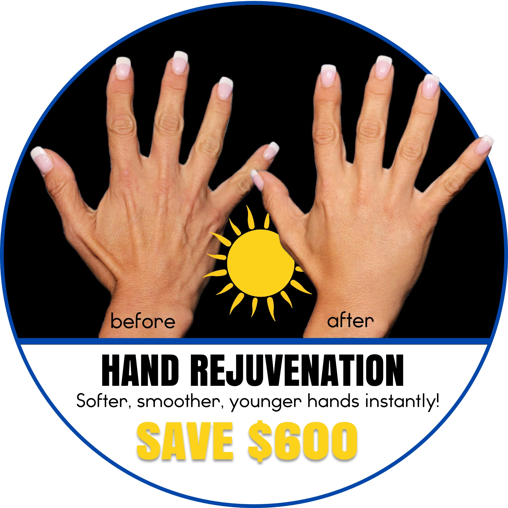 🌸Summer Hand Rejuvenation
