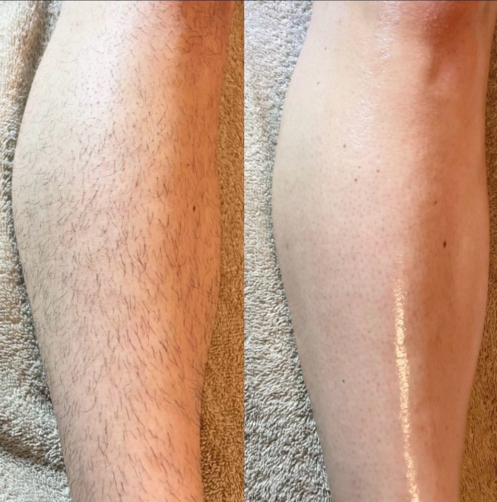 LEG WAX (Full Or Half Leg $ Varies) at Belleza Esthetics in Everett, WA