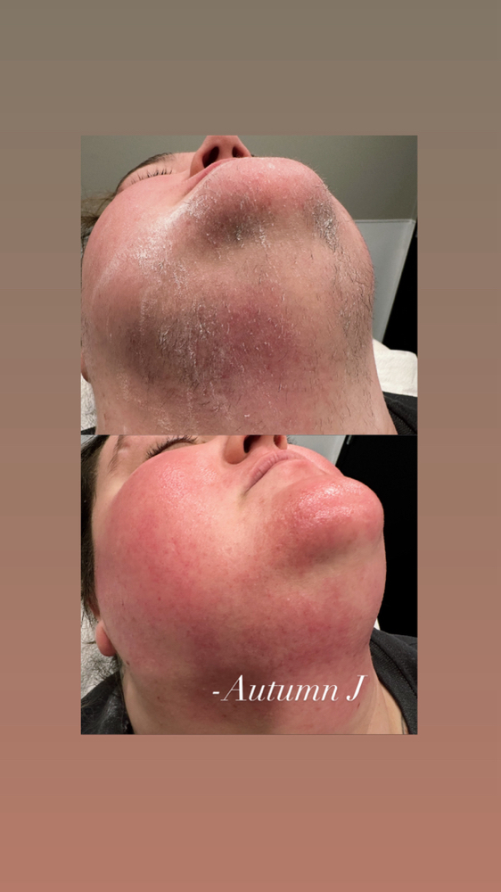 Full Face Wax