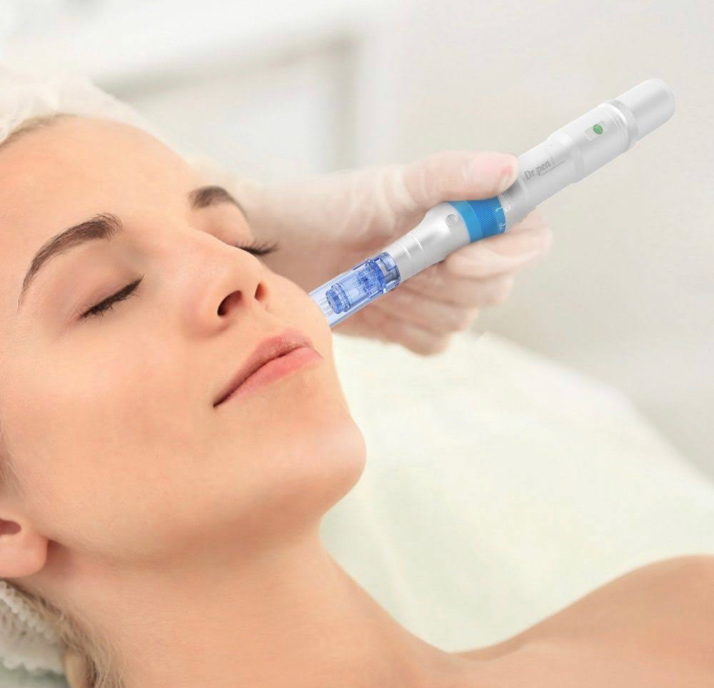 Microneedling