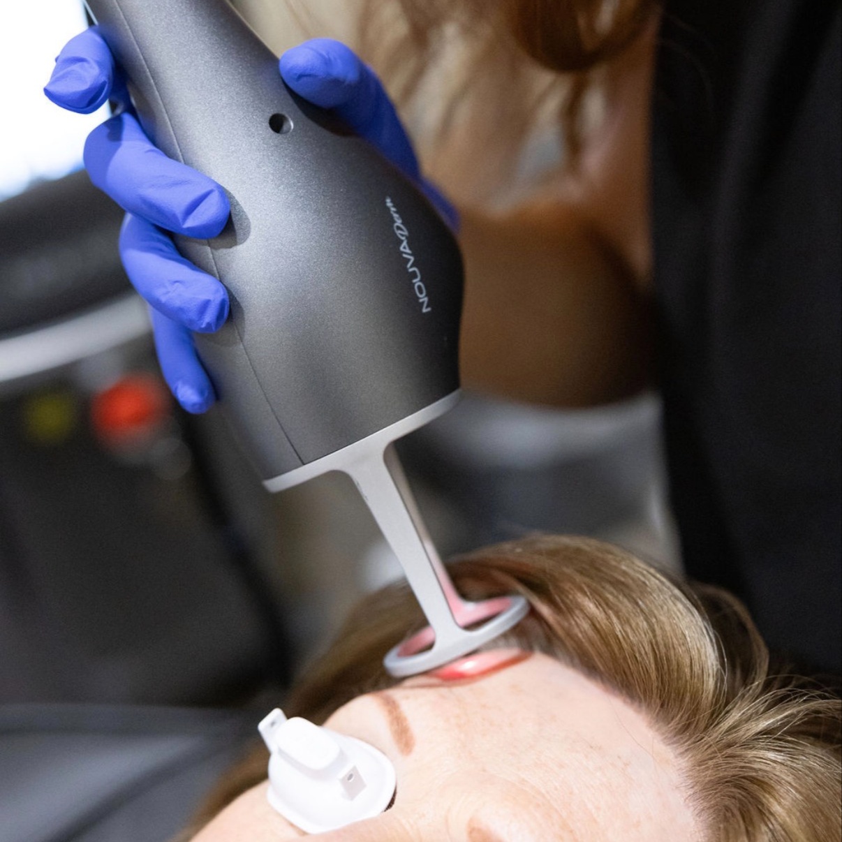 NouvaDerm Light at Revitalize Health in Florence, SC